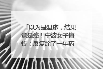 以为是湿疹，结果竟是癌！宁波女子悔惨：反复涂了一年药膏都没好！很多患者首诊都去了皮肤科